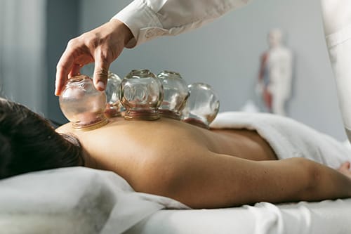 cupping therapy in Habarana